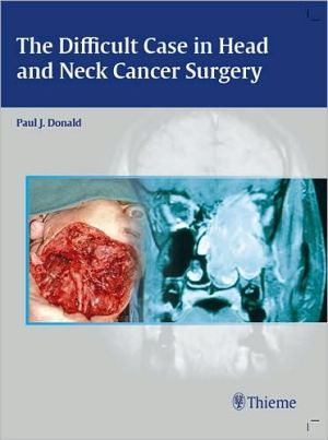 The Difficult Case in Head and Neck Cancer Surgery**