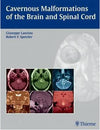 Cavernous Malformations of the Brain and Spinal Cord ** | ABC Books