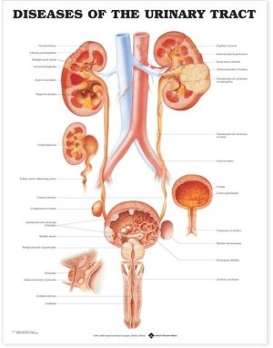 Diseases of the Urinary Tract Anatomical Chart | ABC Books