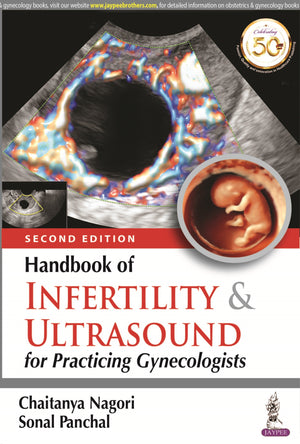 Handbook of Infertility & Ultrasound for Practicing Gynecologists, 2e | ABC Books