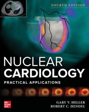 Nuclear Cardiology: Practical Applications, 4e | ABC Books