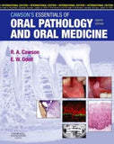Cawson's Essentials of Oral Pathology and Oral Medicine, 8e ** | ABC Books