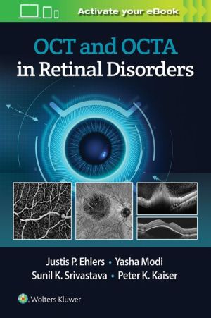 OCT and OCTA in Retinal Disorders | ABC Books