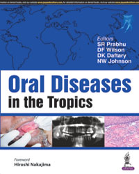 Oral Diseases in the Tropics