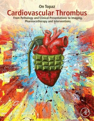 Cardiovascular Thrombus : From Pathology and Clinical Presentations to Imaging, Pharmacotherapy and Interventions