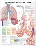 Understanding Asthma Anatomical Chart, 2e | ABC Books