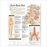 Understanding Low Back Pain Anatomical Chart | ABC Books
