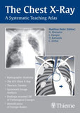 The Chest X-Ray: A Systematic Teaching Atlas | ABC Books