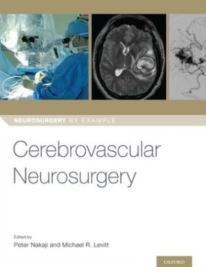 Cerebrovascular Neurosurgery | ABC Books