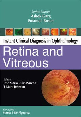 Instant Clinical Diagnosis in Ophthalmology: Retina and Vitreous