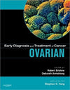 Early Diagnosis and Treatment of Cancer Series: Ovarian Cancer **
