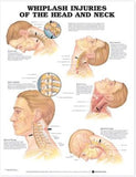 Whiplash Injuries of the Head and Neck Anatomical Chart | ABC Books