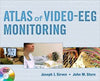 Atlas of Video-EEG Monitoring | ABC Books