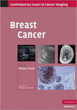 Breast Cancer | ABC Books
