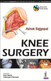 Knee Surgery | ABC Books