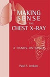 Making Sense of the Chest X-ray : A hands-on guide** | ABC Books
