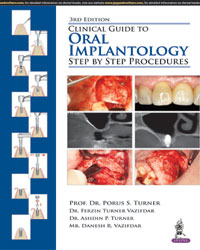 Clinical Guide to Oral Implantology: Step by Step Procedures 3/e | ABC Books
