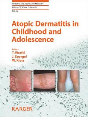 Atopic Dermatitis in Childhood and Adolescence (Pediatric and Adolescent Medicine) | ABC Books