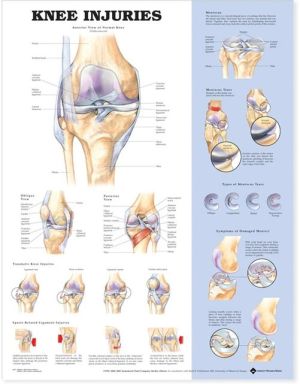 Knee Injuries Anatomical Chart | ABC Books