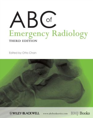 ABC of Emergency Radiology, 3e