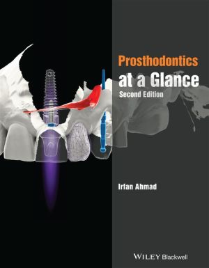 Prosthodontics at a Glance, 2e | ABC Books