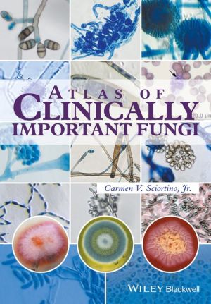 Atlas of Clinically Important Fungi | ABC Books