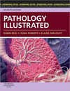 Pathology Illustrated, IE, 7e **