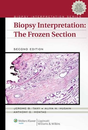 Biopsy Interpretation: The Frozen Section, 2e** | ABC Books