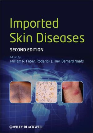 Imported Skin Diseases, 2e