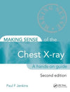 Making Sense of the Chest X-Ray, 2e | ABC Books