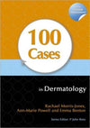 100 Cases in Dermatology | ABC Books
