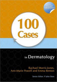 100 Cases in Dermatology | ABC Books
