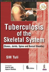 Tuberculosis of the Skeletal System (Bones, Joints, Spine and Bursal Sheaths), 6e | ABC Books