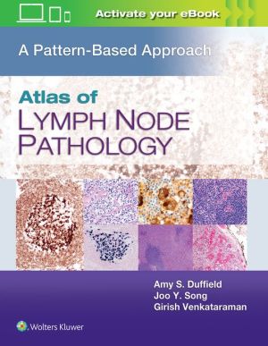 Atlas of Lymph Node Pathology : A Pattern Based Approach | ABC Books