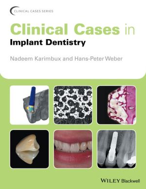 Clinical Cases in Implant Dentistry | ABC Books
