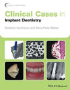 Clinical Cases in Implant Dentistry | ABC Books