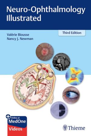 Neuro-Ophthalmology Illustrated, 3e