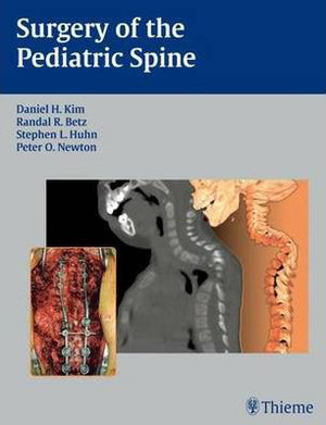 Surgery of the Pediatric Spine **
