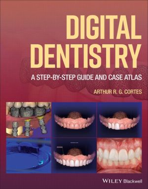 Digital Dentistry: A Step-by-Step Guide and Case Atlas | ABC Books