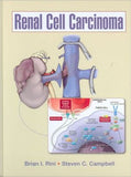 Renal Cell Carcinoma | ABC Books