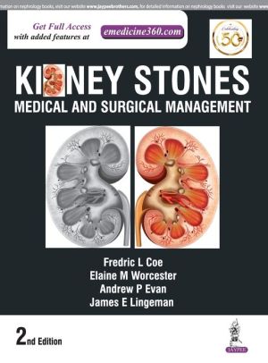 Kidney Stones: Medical and Surgical Management, 2e | ABC Books