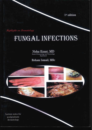 Highlights on Dermatology : Fungal Infections
