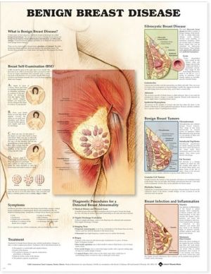 Benign Breast Disease Chart
