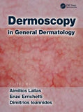 Dermoscopy in General Dermatology