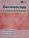 Dermoscopy in General Dermatology | ABC Books