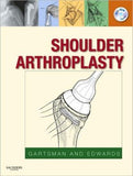 Shoulder Arthroplasty **
