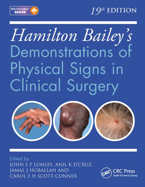 Hamilton Bailey's: Demonstrations of Physical Signs in Clinical Surgery, 19e