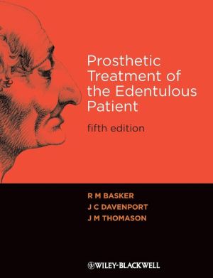 Prosthetic Treatment of the Edentulous Patient, 5e