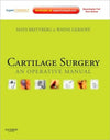 Cartilage Surgery ** | ABC Books
