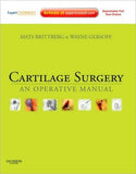 Cartilage Surgery ** | ABC Books
